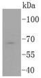 Transcription Factor 7 Like 2 antibody, NBP2-67618, Novus Biologicals, Western Blot image 