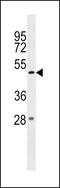 Zinc Finger And BTB Domain Containing 47 antibody, LS-C157394, Lifespan Biosciences, Western Blot image 