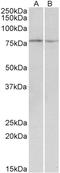 Dystroglycan 1 antibody, LS-B7389, Lifespan Biosciences, Western Blot image 