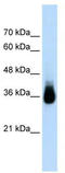 Homeobox protein Hox-C9 antibody, TA343641, Origene, Western Blot image 