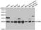 Deoxythymidylate Kinase antibody, A6370, ABclonal Technology, Western Blot image 
