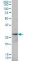 Adenylate Kinase 3 antibody, H00050808-M01, Novus Biologicals, Western Blot image 