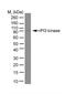 Phosphoinositide-3-Kinase Regulatory Subunit 1 antibody, GTX39409, GeneTex, Western Blot image 