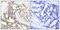 BRCA1 DNA Repair Associated antibody, GTX50272, GeneTex, Immunohistochemistry paraffin image 