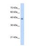 Kynureninase antibody, NBP1-57569, Novus Biologicals, Western Blot image 