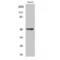 Transcription Factor AP-2 Gamma antibody, LS-C382039, Lifespan Biosciences, Western Blot image 