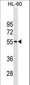 Cyclin Dependent Kinase Inhibitor 1C antibody, LS-C159326, Lifespan Biosciences, Western Blot image 