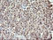 Replication Factor C Subunit 4 antibody, LS-C338065, Lifespan Biosciences, Immunohistochemistry paraffin image 