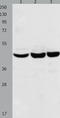 Chromobox 8 antibody, TA322245, Origene, Western Blot image 