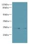 Transmembrane P24 Trafficking Protein 2 antibody, LS-C377163, Lifespan Biosciences, Western Blot image 