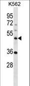 Notchless Homolog 1 antibody, LS-C158399, Lifespan Biosciences, Western Blot image 