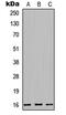 Mitochondrial Ribosomal Protein L42 antibody, abx121524, Abbexa, Western Blot image 