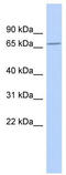 Zinc Finger Protein 404 antibody, TA329724, Origene, Western Blot image 