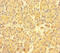 ABI Family Member 3 Binding Protein antibody, LS-C399002, Lifespan Biosciences, Immunohistochemistry paraffin image 