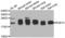 RAB31, Member RAS Oncogene Family antibody, LS-C349198, Lifespan Biosciences, Western Blot image 