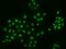 Zinc Finger Protein 384 antibody, 206860-T02, Sino Biological, Immunohistochemistry paraffin image 
