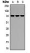 Protein Phosphatase 2 Regulatory Subunit B'Delta antibody, LS-C358249, Lifespan Biosciences, Western Blot image 