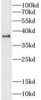 Podoplanin antibody, FNab06598, FineTest, Western Blot image 