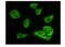 Glycogen Synthase Kinase 3 Alpha antibody, NB110-87048, Novus Biologicals, Immunofluorescence image 