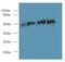 Ferredoxin Reductase antibody, LS-C375700, Lifespan Biosciences, Western Blot image 