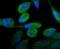 Androgen Receptor antibody, NBP2-67497, Novus Biologicals, Immunofluorescence image 