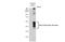 Adrenoceptor Beta 2 antibody, GTX100040, GeneTex, Western Blot image 