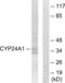 Cytochrome P450 Family 24 Subfamily A Member 1 antibody, abx013978, Abbexa, Western Blot image 