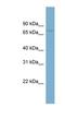 Gigaxonin antibody, NBP1-57821, Novus Biologicals, Western Blot image 