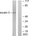 Keratin 5 antibody, LS-B5496, Lifespan Biosciences, Western Blot image 