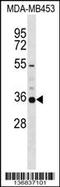 Potassium Voltage-Gated Channel Subfamily A Member 5 antibody, 58-900, ProSci, Western Blot image 