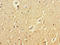 Autophagy Related 5 antibody, A64172-100, Epigentek, Immunohistochemistry paraffin image 