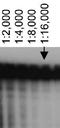 ATP Binding Cassette Subfamily A Member 7 antibody, NB400-166, Novus Biologicals, Western Blot image 