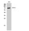 Potassium Voltage-Gated Channel Subfamily D Member 1 antibody, STJ93878, St John