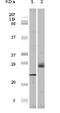 Eukaryotic Translation Initiation Factor 4E Binding Protein 1 antibody, 32-101, ProSci, Enzyme Linked Immunosorbent Assay image 
