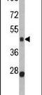 Bone morphogenetic protein 15 antibody, PA5-11713, Invitrogen Antibodies, Western Blot image 