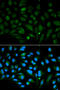 Decorin antibody, A01339, Boster Biological Technology, Western Blot image 