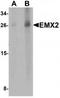 EMX2 antibody, TA319639, Origene, Western Blot image 