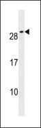 Cripto, FRL-1, Cryptic Family 1B antibody, 59-727, ProSci, Western Blot image 