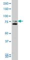 Smoothened, Frizzled Class Receptor antibody, H00006608-M11, Novus Biologicals, Western Blot image 