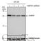 Heat Shock Protein Family B (Small) Member 1 antibody, GTX112964, GeneTex, Western Blot image 