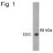 Dopa Decarboxylase antibody, PA1-4652, Invitrogen Antibodies, Western Blot image 