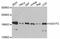 GRB10 Interacting GYF Protein 2 antibody, A12069, ABclonal Technology, Western Blot image 