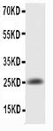 IL-6 antibody, PB9005, Boster Biological Technology, Western Blot image 