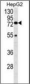 Hexosaminidase Subunit Alpha antibody, orb314112, Biorbyt, Western Blot image 