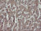 Protein Disulfide Isomerase Family A Member 3 antibody, M01464-3, Boster Biological Technology, Immunohistochemistry paraffin image 
