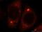 Glycosyltransferase Like Domain Containing 1 antibody, 16666-1-AP, Proteintech Group, Immunofluorescence image 