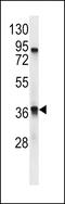 Trace Amine Associated Receptor 9 (Gene/Pseudogene) antibody, LS-C157126, Lifespan Biosciences, Western Blot image 