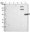 Calpain 10 antibody, NBP1-87489, Novus Biologicals, Western Blot image 