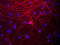 Neurofilament Medium antibody, LS-C204562, Lifespan Biosciences, Immunocytochemistry image 