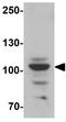 Rap Guanine Nucleotide Exchange Factor 3 antibody, GTX32047, GeneTex, Western Blot image 